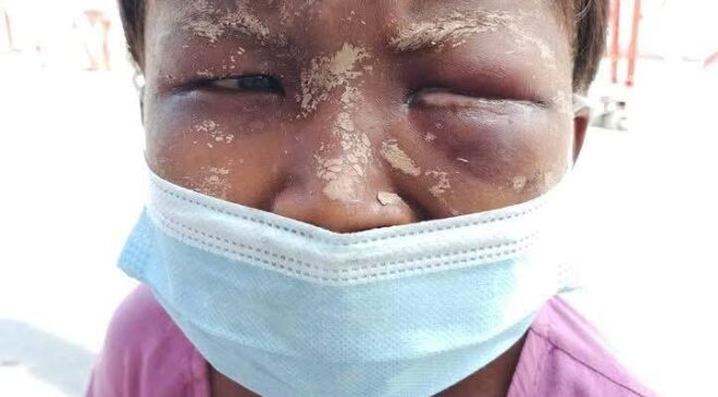 မန္တလေးမှာ ကလေးတွေကို ဖမ်းဆီးနှိပ်စက် တောင်းရမ်းခိုင်းနေတဲ့ အဖွဲ့တွေကို ဖမ်းဆီးဖို့ လို